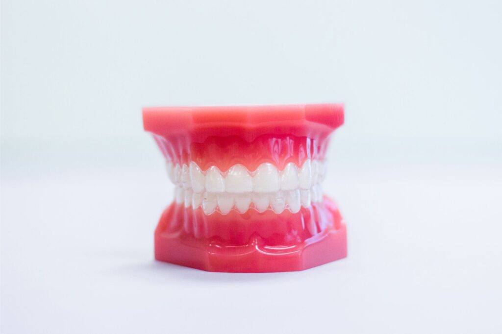Dental model with clear aligners fitted over the upper and lower teeth